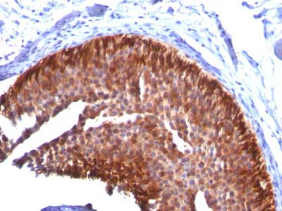 Immunohistochemistry (Formalin/PFA-fixed paraffin-embedded sections) - Anti-Cytokeratin 17 antibody [KRT17/778] - BSA and Azide free (AB212553)