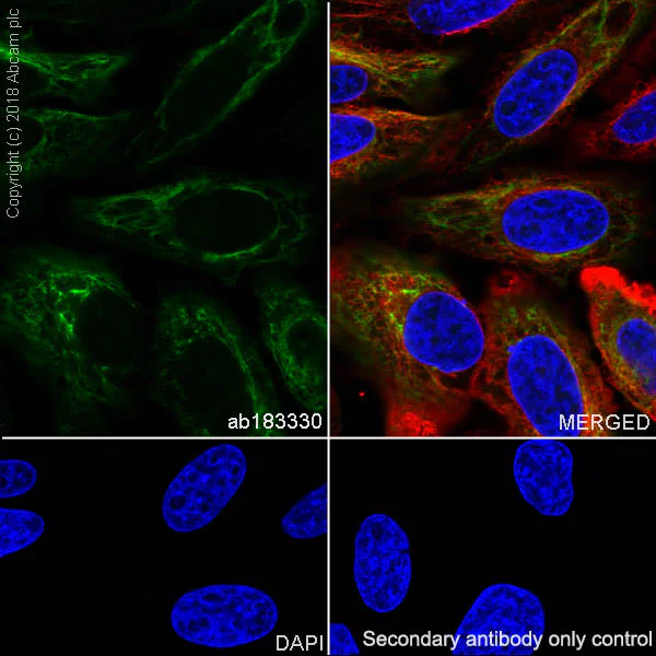 Immunocytochemistry/ Immunofluorescence - Anti-Cytokeratin 17 antibody [SP95] - BSA and Azide free (AB238808)