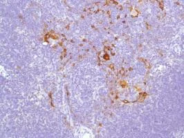Immunohistochemistry (Formalin/PFA-fixed paraffin-embedded sections) - Anti-Cytokeratin 17 antibody [SP95] - BSA and Azide free (AB238808)