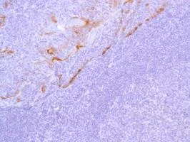 Immunohistochemistry (Formalin/PFA-fixed paraffin-embedded sections) - Anti-Cytokeratin 17 antibody [SP95] - BSA and Azide free (AB238808)