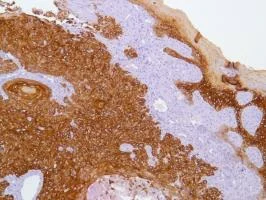 Immunohistochemistry (Formalin/PFA-fixed paraffin-embedded sections) - Anti-Cytokeratin 17 antibody [SP95] - BSA and Azide free (AB238808)