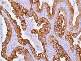 Immunohistochemistry (Formalin/PFA-fixed paraffin-embedded sections) - Anti-Cytokeratin 17 antibody [SP95] - BSA and Azide free (AB238808)
