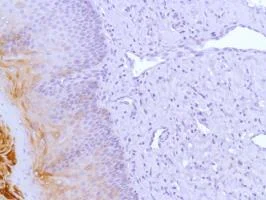 Immunohistochemistry (Formalin/PFA-fixed paraffin-embedded sections) - Anti-Cytokeratin 17 antibody [SP95] - BSA and Azide free (AB238808)