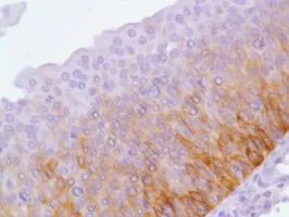 Immunohistochemistry (Formalin/PFA-fixed paraffin-embedded sections) - Anti-Cytokeratin 17 antibody [SP95] - C-terminal (AB183330)