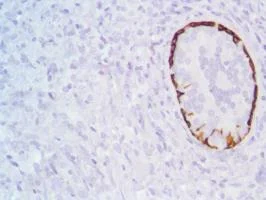 Immunohistochemistry (Formalin/PFA-fixed paraffin-embedded sections) - Anti-Cytokeratin 17 antibody [SP95] - C-terminal (AB183330)
