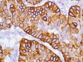 Immunohistochemistry (Formalin/PFA-fixed paraffin-embedded sections) - Anti-Cytokeratin 17 antibody [SP95] - C-terminal (AB183330)