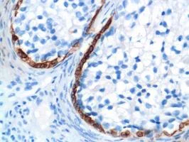 Immunohistochemistry (Formalin/PFA-fixed paraffin-embedded sections) - Anti-Cytokeratin 17 antibody [SP95] - C-terminal (AB183330)