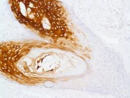 Immunohistochemistry (Formalin/PFA-fixed paraffin-embedded sections) - Anti-Cytokeratin 17 antibody [SP95] - C-terminal (AB183330)