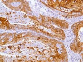 Immunohistochemistry (Formalin/PFA-fixed paraffin-embedded sections) - Anti-Cytokeratin 17 antibody [SP95] - C-terminal (AB183330)