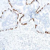 Immunohistochemistry (Formalin/PFA-fixed paraffin-embedded sections) - Anti-Cytokeratin 17 antibody [SP95] - C-terminal (AB183330)