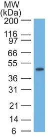 Western blot - Anti-Cytokeratin 17 antibody [SPM560] (AB233912)