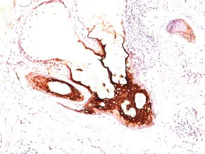 Immunohistochemistry (Formalin/PFA-fixed paraffin-embedded sections) - Anti-Cytokeratin 17 antibody [SPM560] - BSA and Azide free (AB212552)
