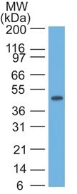 Western blot - Anti-Cytokeratin 17 antibody [SPM560] - BSA and Azide free (AB212552), expandable thumbnail