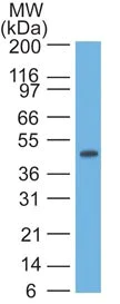 Western blot - Anti-Cytokeratin 17 antibody [SPM560] - BSA and Azide free (AB212552)