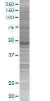 Cytokeratin 17 overexpression 293T lysate (whole cell)
