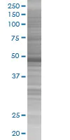 SDS-PAGE - Cytokeratin 17 overexpression 293T lysate (whole cell) (AB94233)