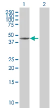 Western blot - Cytokeratin 17 overexpression 293T lysate (whole cell) (AB94233)