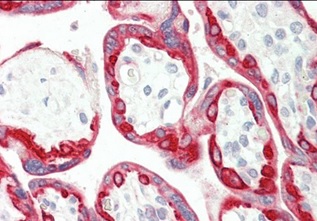 Immunohistochemistry (Formalin/PFA-fixed paraffin-embedded sections) - Anti-Cytokeratin 18 antibody (AB219271)
