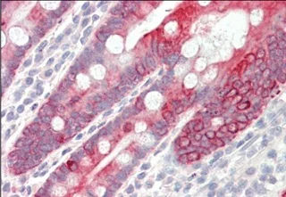 Immunohistochemistry (Formalin/PFA-fixed paraffin-embedded sections) - Anti-Cytokeratin 18 antibody (AB219271)