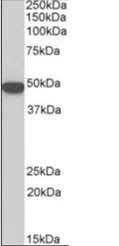 Western blot - Anti-Cytokeratin 18 antibody (AB219271)