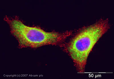 Immunocytochemistry/ Immunofluorescence - Anti-Cytokeratin 18 antibody (AB24561)