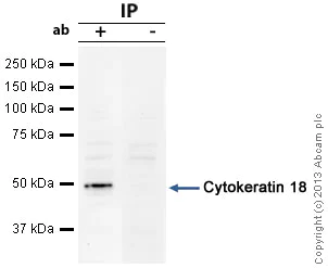 Immunoprecipitation - Anti-Cytokeratin 18 antibody (AB24561)