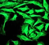 Immunocytochemistry/ Immunofluorescence - Anti-Cytokeratin 18 antibody (AB52948)