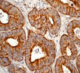 Immunohistochemistry (Formalin/PFA-fixed paraffin-embedded sections) - Anti-Cytokeratin 18 antibody (AB52948)