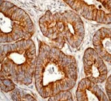 Immunohistochemistry (Formalin/PFA-fixed paraffin-embedded sections) - Anti-Cytokeratin 18 antibody (AB52948)