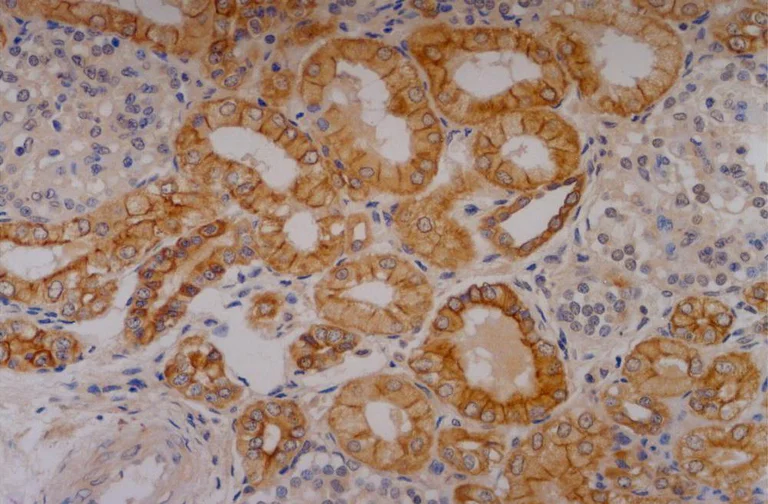 Immunohistochemistry (Formalin/PFA-fixed paraffin-embedded sections) - Anti-Cytokeratin 18 antibody [C-04] (AB668)