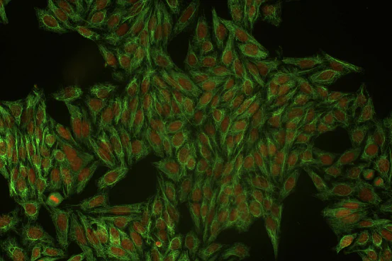 Immunocytochemistry/ Immunofluorescence - Anti-Cytokeratin 18 antibody [DC 10] (AB7797)