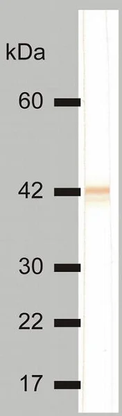 Western blot - Anti-Cytokeratin 18 antibody [DC 10] (AB7797)