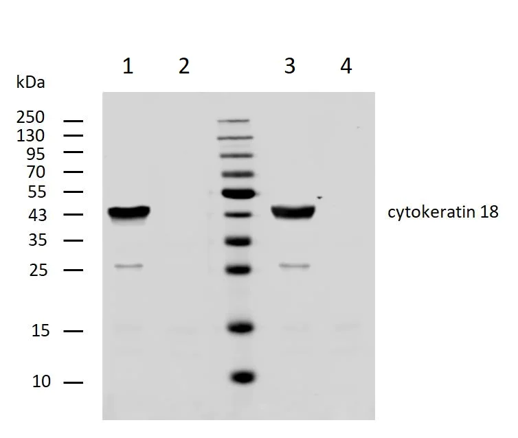 Western blot - Anti-Cytokeratin 18 antibody [DC 10] (AB7797)