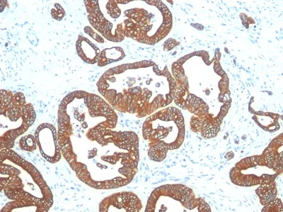 Immunohistochemistry (Formalin/PFA-fixed paraffin-embedded sections) - Anti-Cytokeratin 18 antibody [DE-K18] (AB233915)