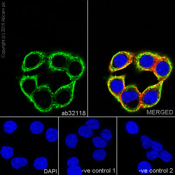 Immunocytochemistry/ Immunofluorescence - Anti-Cytokeratin 18 antibody [E431-1] (AB32118)
