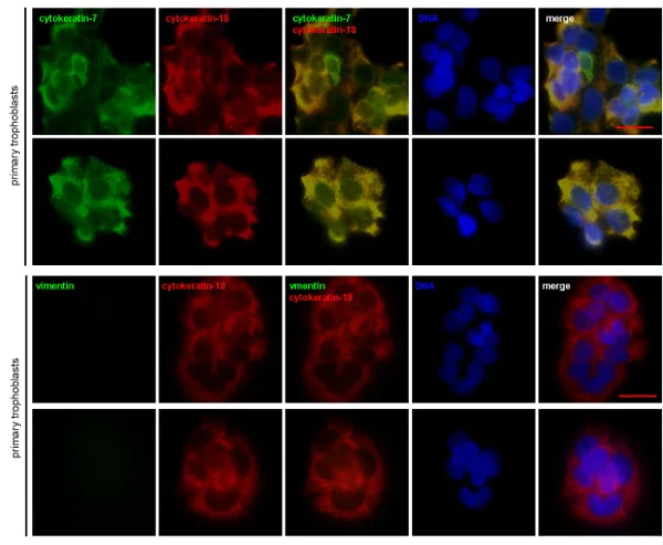 Immunocytochemistry/ Immunofluorescence - Anti-Cytokeratin 18 antibody [E431-1] (AB32118)