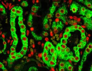 Immunohistochemistry (Formalin/PFA-fixed paraffin-embedded sections) - Anti-Cytokeratin 18 antibody [E431-1] (AB32118)