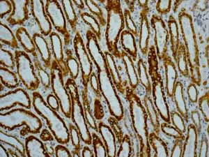 Immunohistochemistry (Formalin/PFA-fixed paraffin-embedded sections) - Anti-Cytokeratin 18 antibody [E431-1] (AB32118)