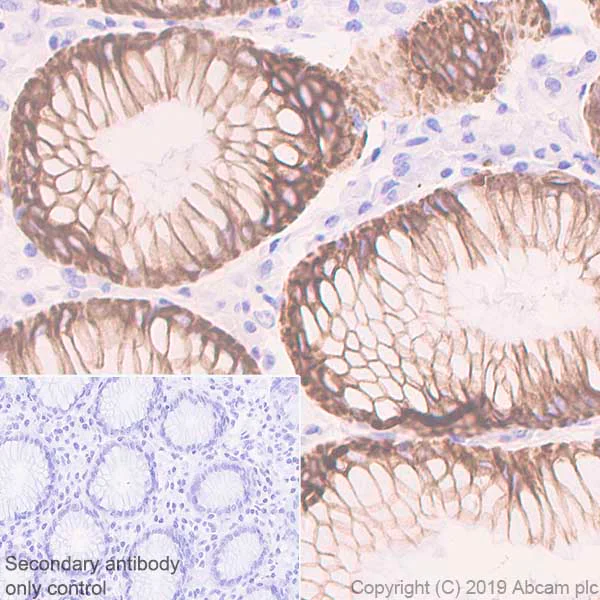 Immunohistochemistry (Formalin/PFA-fixed paraffin-embedded sections) - Anti-Cytokeratin 18 antibody [E431-1] (AB32118)