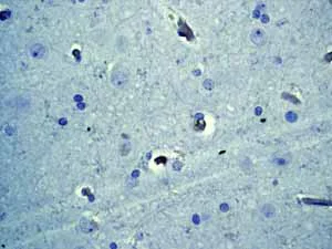 Immunohistochemistry (Formalin/PFA-fixed paraffin-embedded sections) - Anti-Cytokeratin 18 antibody [E431-1] - BSA and Azide free (AB193557)