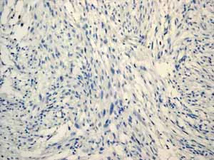 Immunohistochemistry (Formalin/PFA-fixed paraffin-embedded sections) - Anti-Cytokeratin 18 antibody [E431-1] - BSA and Azide free (AB193557)