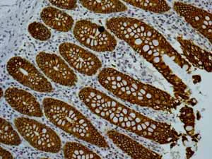 Immunohistochemistry (Formalin/PFA-fixed paraffin-embedded sections) - Anti-Cytokeratin 18 antibody [E431-1] - BSA and Azide free (AB193557)