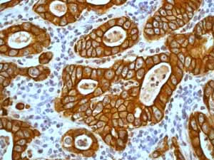 Immunohistochemistry (Formalin/PFA-fixed paraffin-embedded sections) - Anti-Cytokeratin 18 antibody [E431-1] - BSA and Azide free (AB193557)