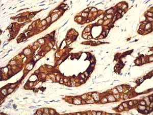 Immunohistochemistry (Formalin/PFA-fixed paraffin-embedded sections) - Anti-Cytokeratin 18 antibody [E431-1] - BSA and Azide free (AB193557)