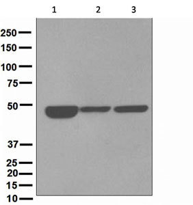 Western blot - Anti-Cytokeratin 18 antibody [EPR1611] (AB133302), expandable thumbnail