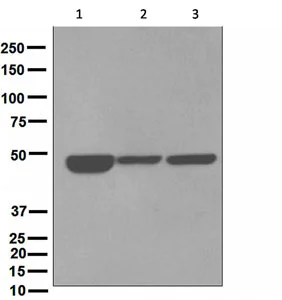 Western blot - Anti-Cytokeratin 18 antibody [EPR1611] (AB133302)