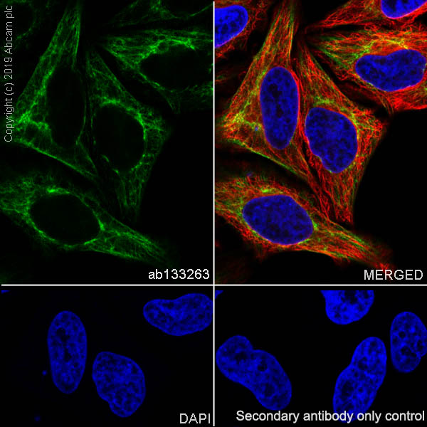 Immunocytochemistry/ Immunofluorescence - Anti-Cytokeratin 18 antibody [EPR1626] (AB133263), expandable thumbnail