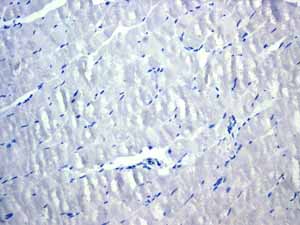 Immunohistochemistry (Formalin/PFA-fixed paraffin-embedded sections) - Anti-Cytokeratin 18 antibody [EPR1626] (ab133263), expandable thumbnail