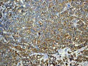 Immunohistochemistry (Formalin/PFA-fixed paraffin-embedded sections) - Anti-Cytokeratin 18 antibody [EPR1626] (ab133263), expandable thumbnail