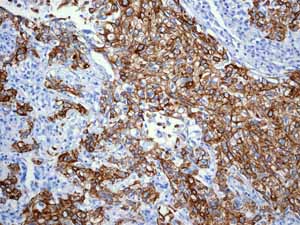 Immunohistochemistry (Formalin/PFA-fixed paraffin-embedded sections) - Anti-Cytokeratin 18 antibody [EPR1626] (ab133263), expandable thumbnail
